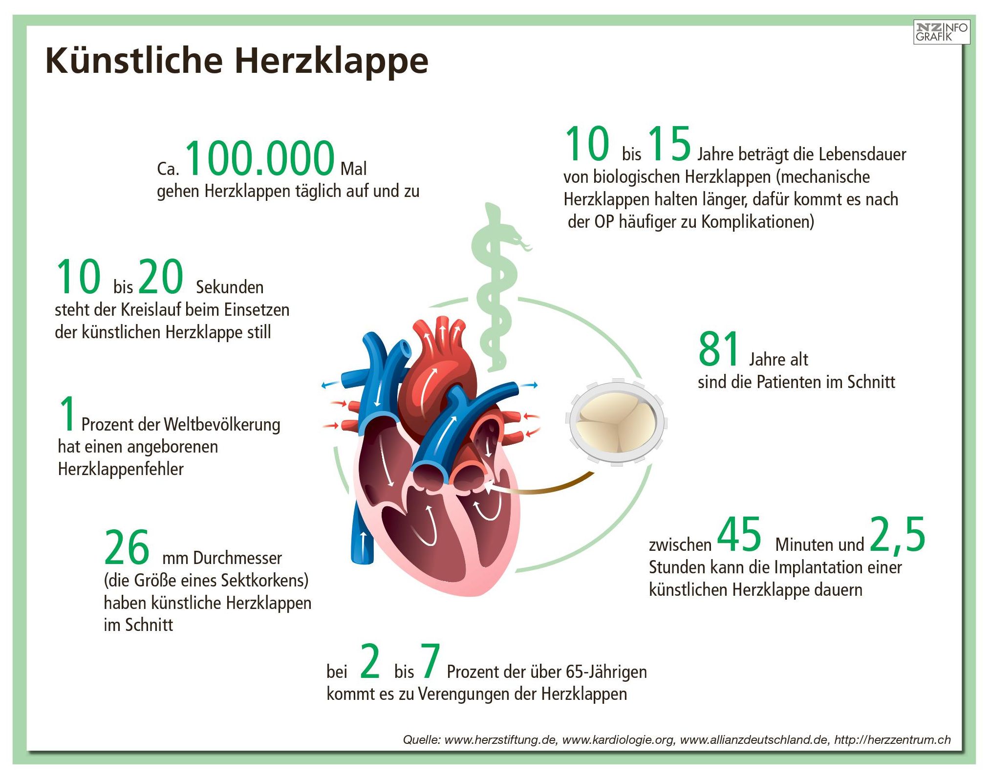 Herzklappen-OP: Nürnberg Und Erlangen Siegen Im NZ-Klinikcheck ...